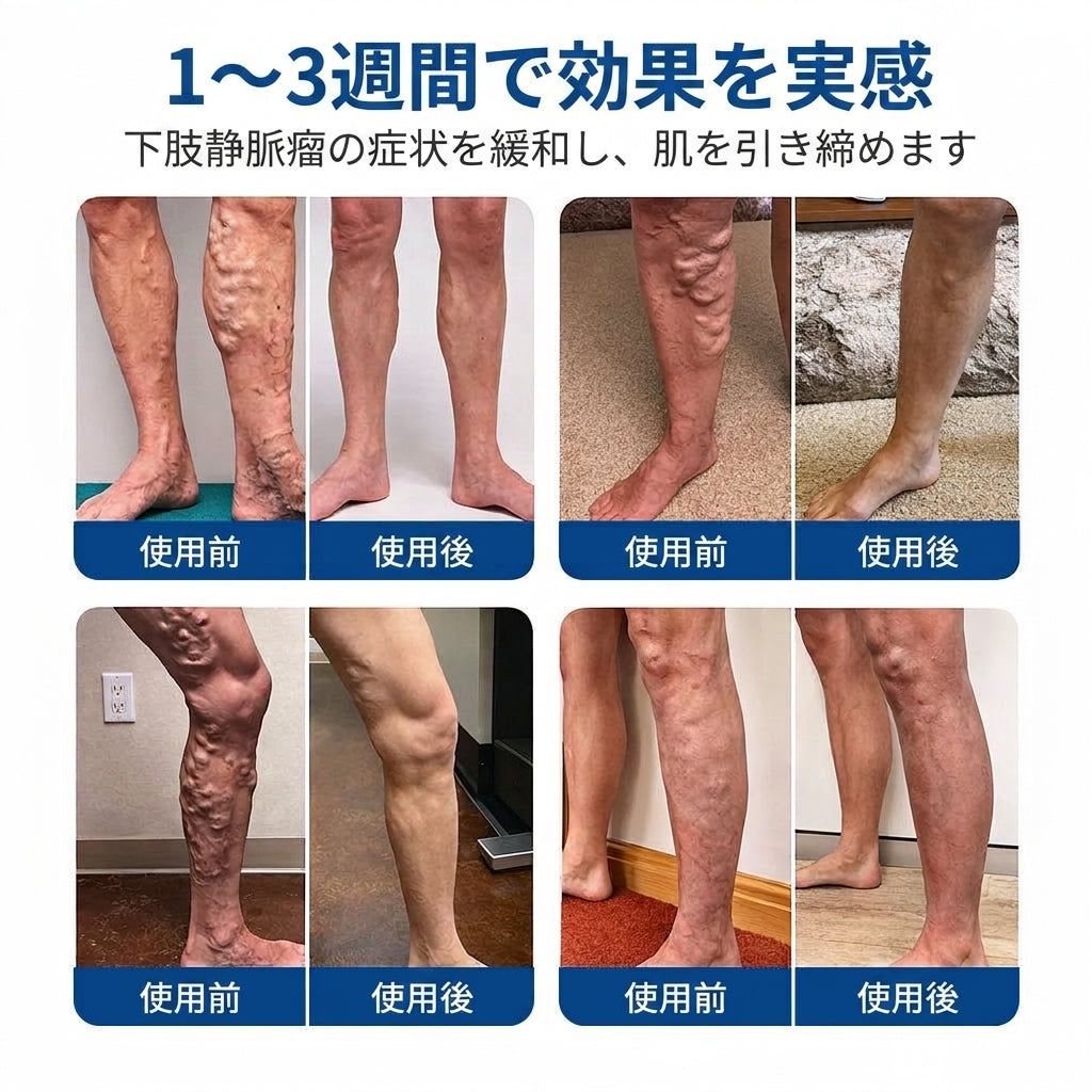 FFBSI® 脚の悩みに寄り添うマイクロニードルケアパッチ ⚡ 貼るだけの簡単ケアで、すっきり快適な毎日へ