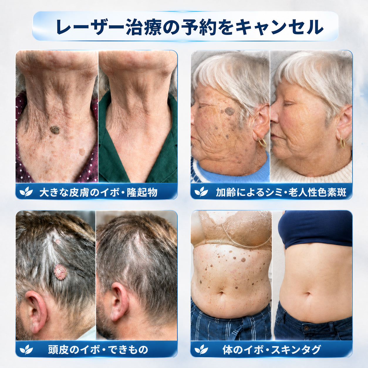 Hiskin®🎁から特別なアップグレード特典をご用意しました。すでにお得なオファーをご利用いただいていますが、さらに今だけ、よりお得な限定特典が解放されました！