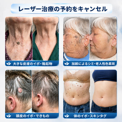 Hiskin®🎁から特別なアップグレード特典をご用意しました。すでにお得なオファーをご利用いただいていますが、さらに今だけ、よりお得な限定特典が解放されました！