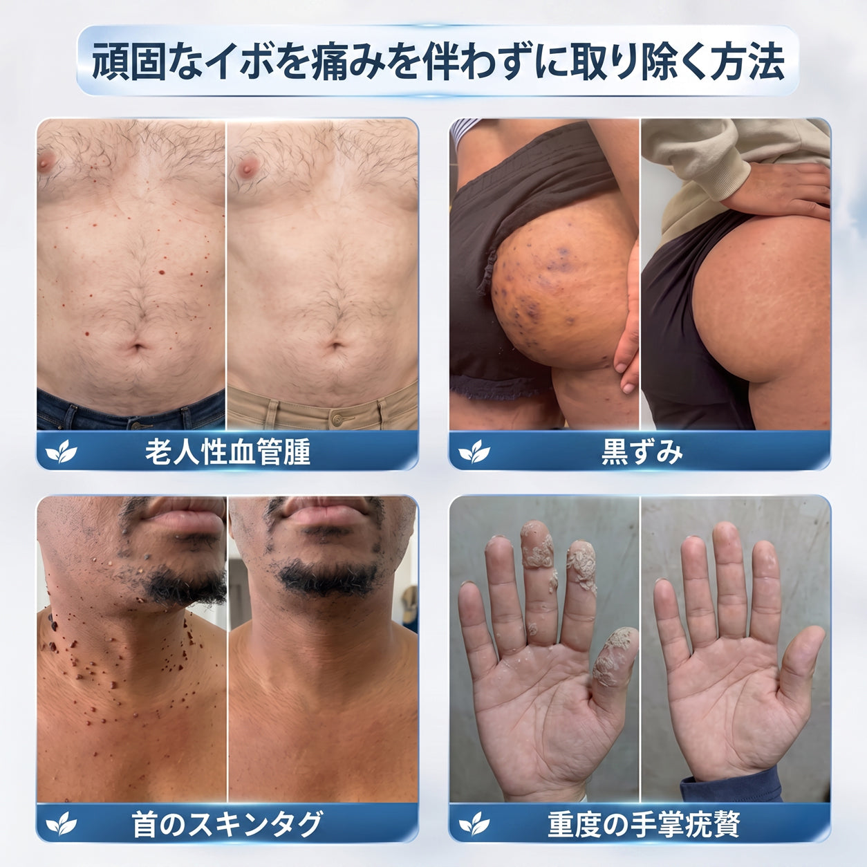 Hiskin®🎁から特別なアップグレード特典をご用意しました。すでにお得なオファーをご利用いただいていますが、さらに今だけ、よりお得な限定特典が解放されました！