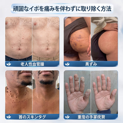 Hiskin®🎁から特別なアップグレード特典をご用意しました。すでにお得なオファーをご利用いただいていますが、さらに今だけ、よりお得な限定特典が解放されました！