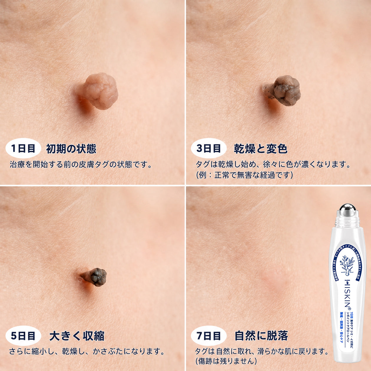 Hiskin®🎁から特別なアップグレード特典をご用意しました。すでにお得なオファーをご利用いただいていますが、さらに今だけ、よりお得な限定特典が解放されました！