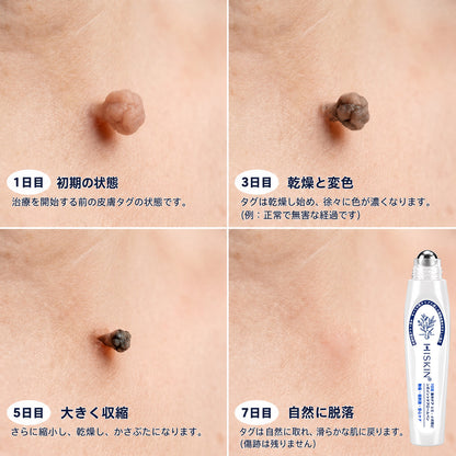 Hiskin®🎁から特別なアップグレード特典をご用意しました。すでにお得なオファーをご利用いただいていますが、さらに今だけ、よりお得な限定特典が解放されました！